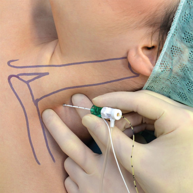 Dr. Thiago Bernado